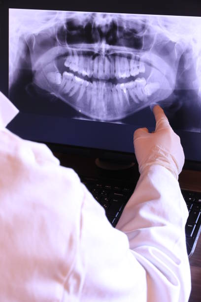 Best Dentist for Tooth Abscess  in Mamou, LA