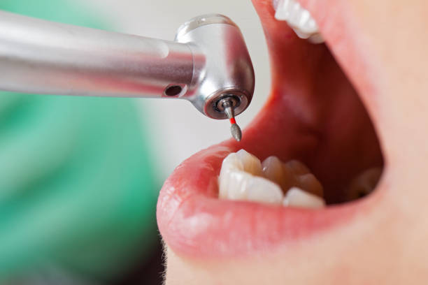 Best Tooth Infection Emergency Dentist  in Mamou, LA